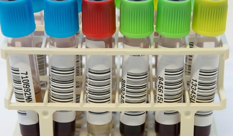 Laboratoria Anna Ziekenhuis en Kempenhaeghe trekken bij elkaar in